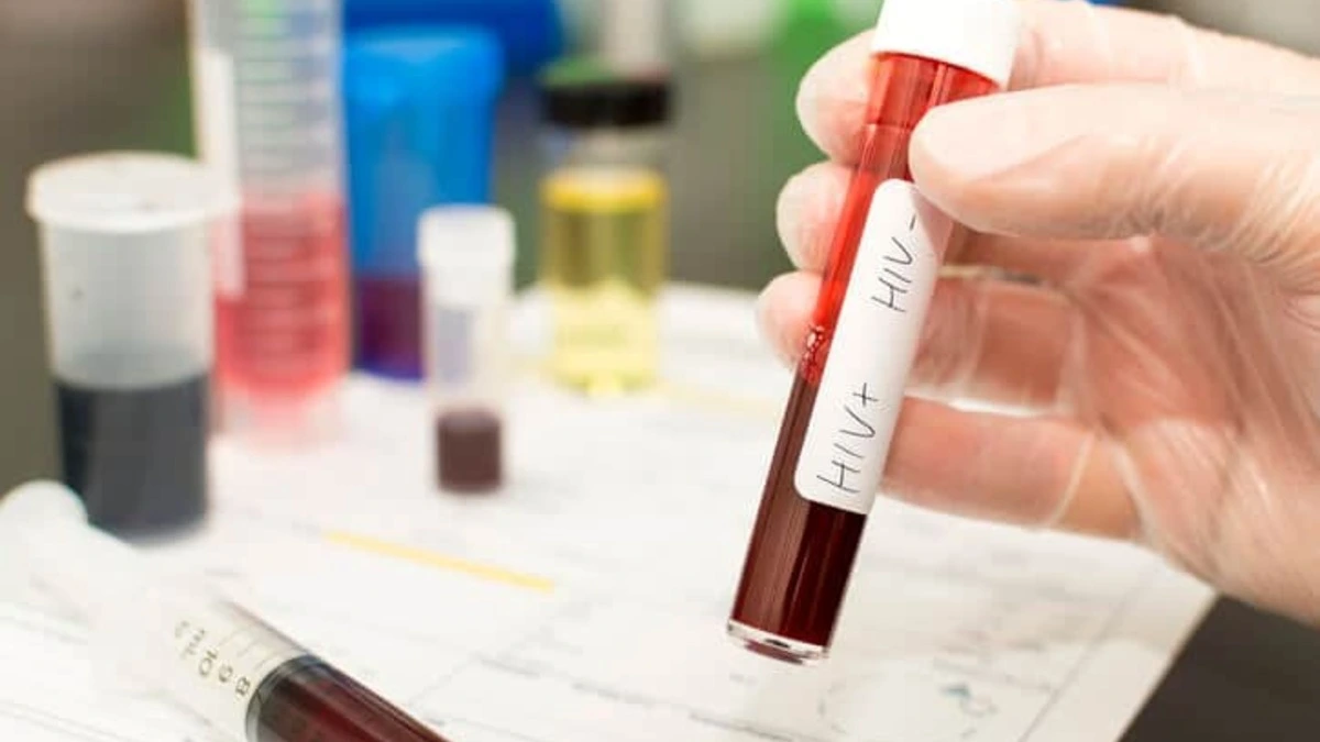 Estudiante contrae VIH en laboratorio universitario; La indemnizan con 2.6 mdp